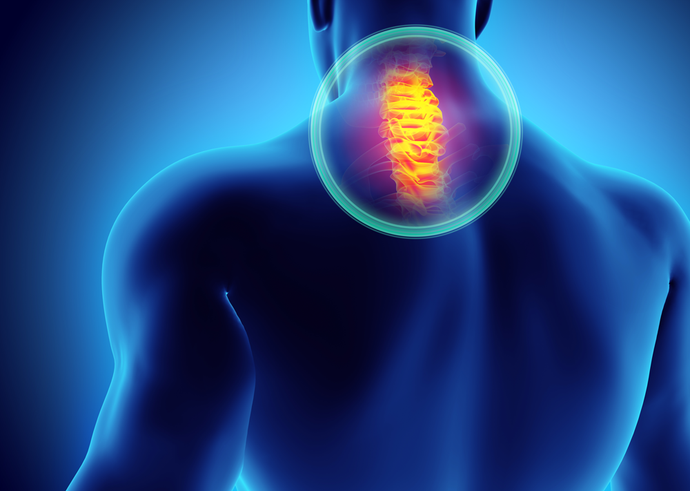 Neck Pain and the Injured Worker: Causes, Diagnoses, and Treatment
